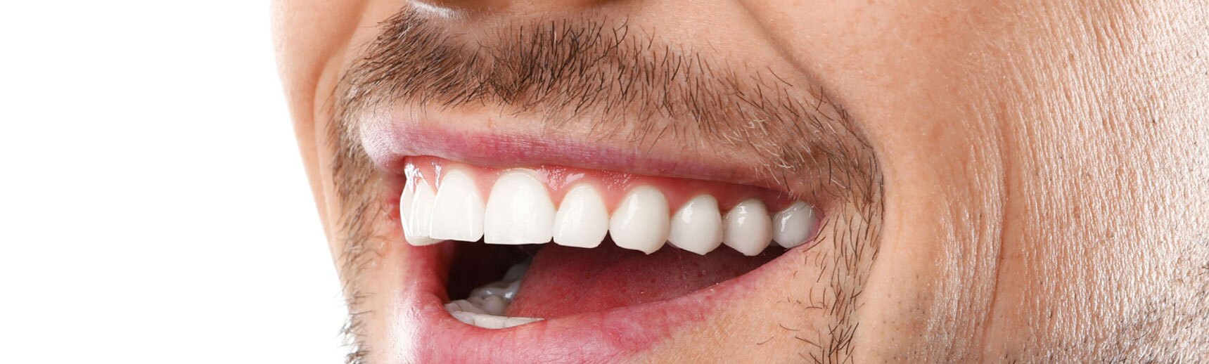 After dental treatment