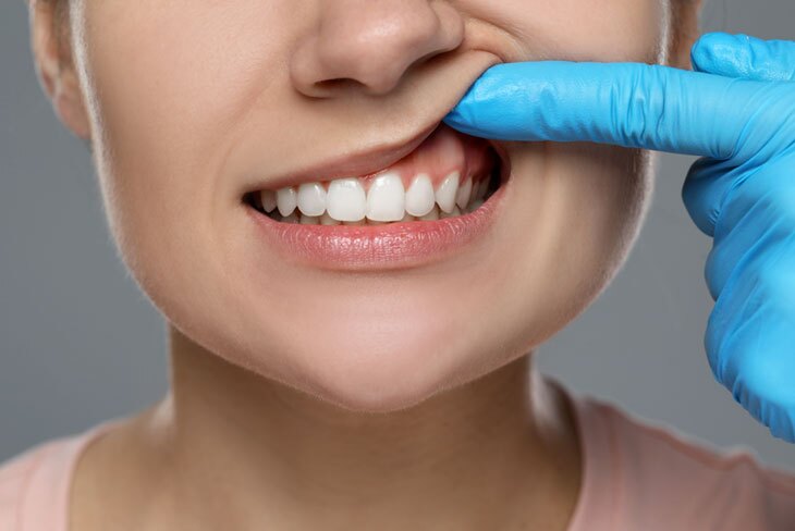 The Importance of Periodontal Treatment