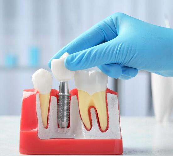 Prosthodontics