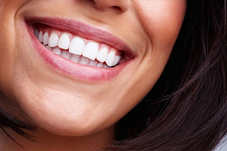 Cosmetic Dentistry Mississauga