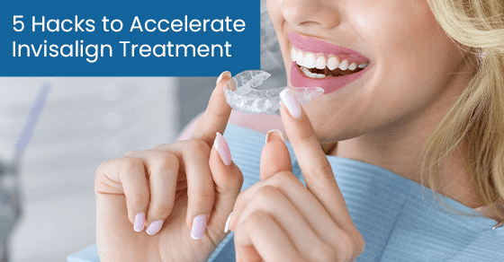 5 hacks to accelerate invisalign treatment