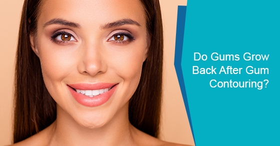 Will gums grow back after gum contouring?