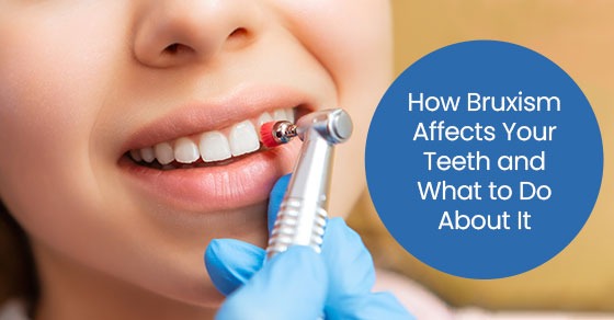 How bruxism affects your teeth and what to do about it